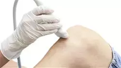 practicas ecografia musculoesqueletica medicina rehabilitadora Tech Universidad