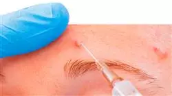practicas tratamiento acne Tech Universidad