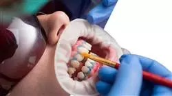 praktikumsprogramm adhasive asthetische zahnmedizin Tech Universidad