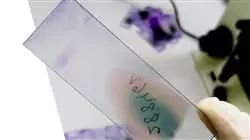 praktikumsprogramm genom prazisionsmedizin hamatologie thrombose Tech Universidad
