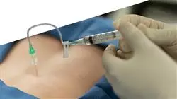 praktikumsprogramm schmerzbehandlung krankenpflege Tech Universidad