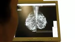prasenzstudium angewandte senologie brustkrebsbehandlung Tech Universidad