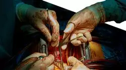 prasenzstudium onkologische kardiologie Tech Universidad
