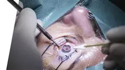 prasenzstudium pathologie chirurgie makula netzhaut glaskorpers Tech Universidad