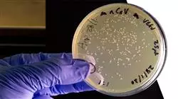 prasenztudium klinische infektiologie antibiotikatherapie Tech Universidad