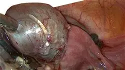 praxisorientierte ausbildung endometriose Tech Universidad