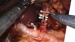 praxisorientierte ausbildung fortschritte padiatrischen gastroenterologie hepatologie Tech Universidad