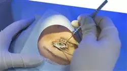 praxisorientierte ausbildung krankenpflege ophthalmologie Tech Universidad