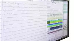 praxisorientierte ausbildungaktualisierung neurophysiologische diagnose behandlung Tech Universidad