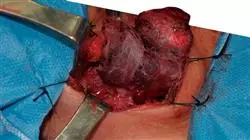 professional practices cancer unknown origin Tech Universidad