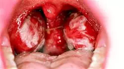 professional practices infectious diseases emergency department Tech Universidad