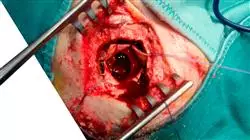professional practices neurosurgery Tech Universidad
