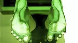 professional practices pediatric orthopedics physiotherapy Tech Universidad