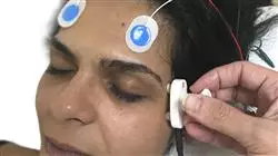 programa estagio atualizacao diagnostico tratamento neurofisiologico Tech Universidad