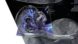 programa estagio obstetricia enfermeiros obstetras Tech Universidad