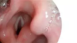 programa estagios neurorreabilitacao fonoaudiologica orofacial Tech Universidad