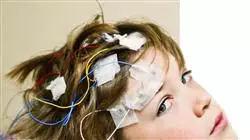 programa practicas actualizacion neurologia Tech Universidad