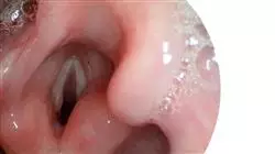 programa practicas neurorrehabilitacion logopedica orofacial enfermeria Tech Universidad