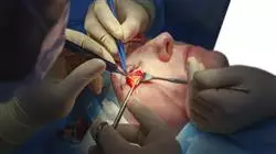 programa practicas oftalmologia clinica Tech Universidad