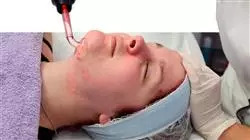 programa practicas tratamiento acne Tech Universidad