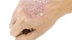 semipresencial actualizacion dermatologia clinica Tech Universidad