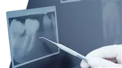 semipresencial odontologia pediatrica actualizada Tech Universidad