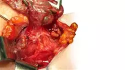 stage universitari aggiornamento endocrinologia Tech Universidad