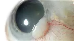 stage universitari neuroftalmologia Tech Universidad