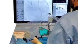 stage universitari sindrome coronarica acuta Tech Universidad