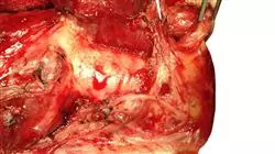 stage universitario aggiornamento endocrinologia Tech Universidad