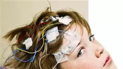 stage universitario aggiornamento neurologia Tech Universidad