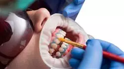 stage universitario odontoiatria estetica adesiva Tech Universidad