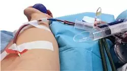 stage universitario progressi ematologia emoterapia Tech Universidad