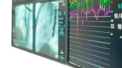 stage universitario sindrome coronarica acuta Tech Universidad
