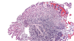 study update endocrinology TECH Global University