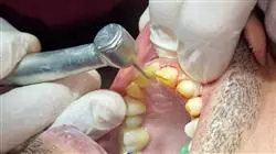 vocational apprenticeships dental prosthesis Tech Universidad