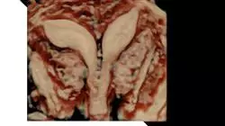 vocational apprenticeships obstetrics midwives Tech Universidad