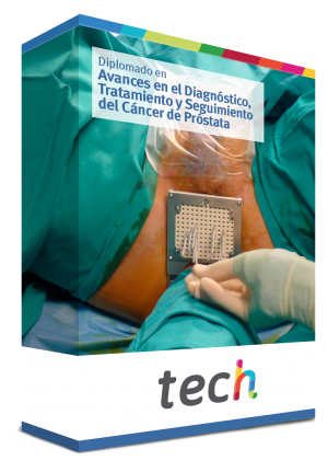 prueba de cáncer de próstata epigenéticas