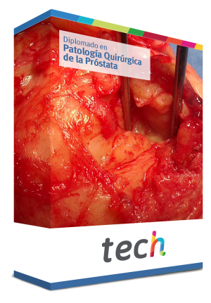 z opiniones sobre medicamentos para la prostatitis z opiniones sobre medicamentos para la prostatitis