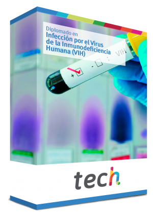diagnóstico de la infección por el virus de la inmunodeficiencia humana